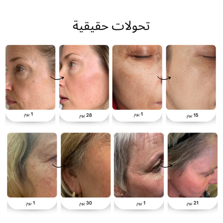 لؤلؤة الصحراء — زيت بذور التين الشوكي