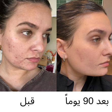 لؤلؤة الصحراء — زيت بذور التين الشوكي